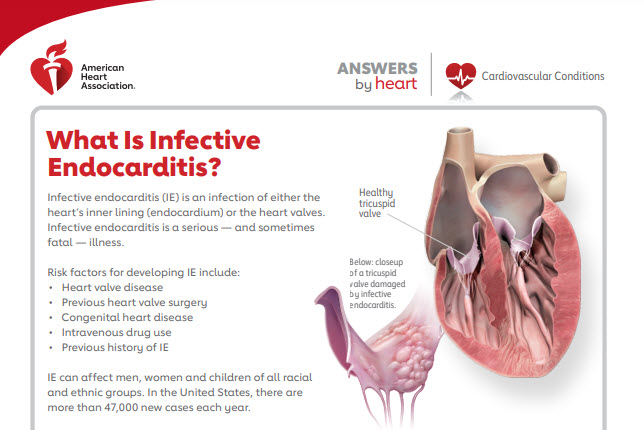 Answers by Heart infective endocarditis