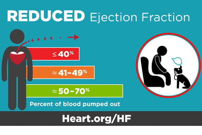 Ejection fraction