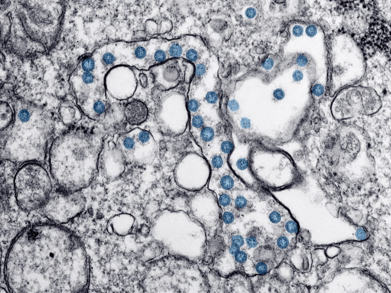 Microscopic image of COVID-19. (Hannah A. Bullock, Azaibi Tamin/CDC)