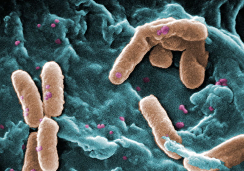 Pseudomonas aeruginosa bacteria. (CDC/Janice Haney Carr)