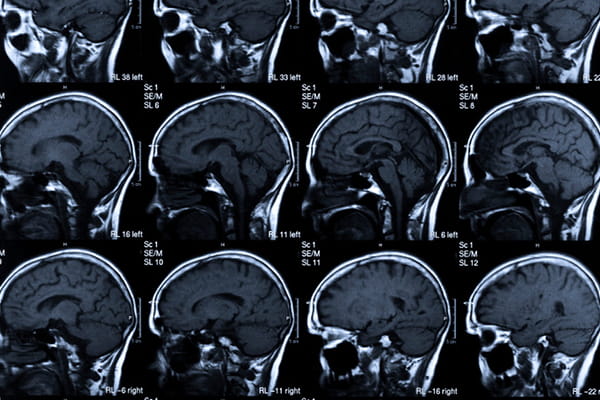 photo of multiple brain scans
